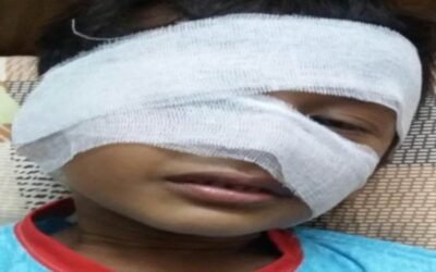 चाईना डोर की चपेट में आया छह वर्षीय मासूम