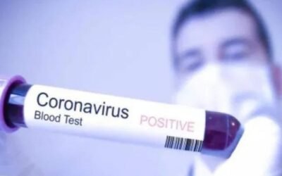 जालंधर में शुक्रवार को भी कोरोना का बड़ा धमाका, पढ़े शुक्रवार को पाजिटिव आए मामलों के नाम व ईलाके